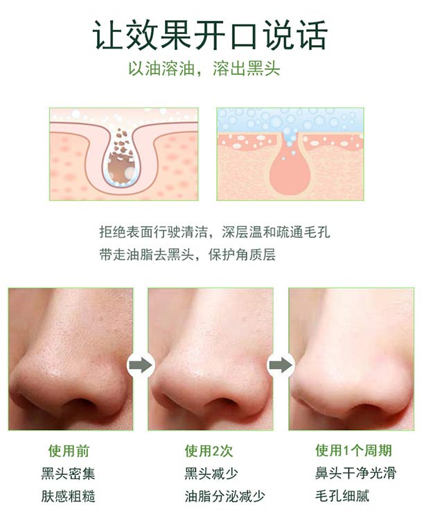 Ԋ�����ȥ���^�o(h��)�����b