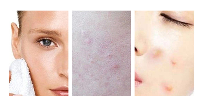 Ԋ(sh��)��������r(sh��)����͸������(y��n)�y��ĭ