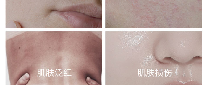 ������������o(h��)ԭҺ